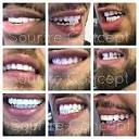 Sourire Concept Coupon Codes
